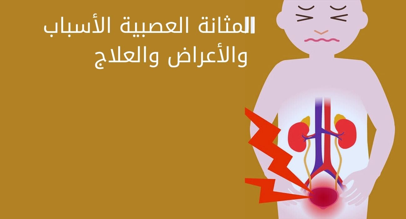 المثانة العصبية الأسباب والأعراض والعلاج